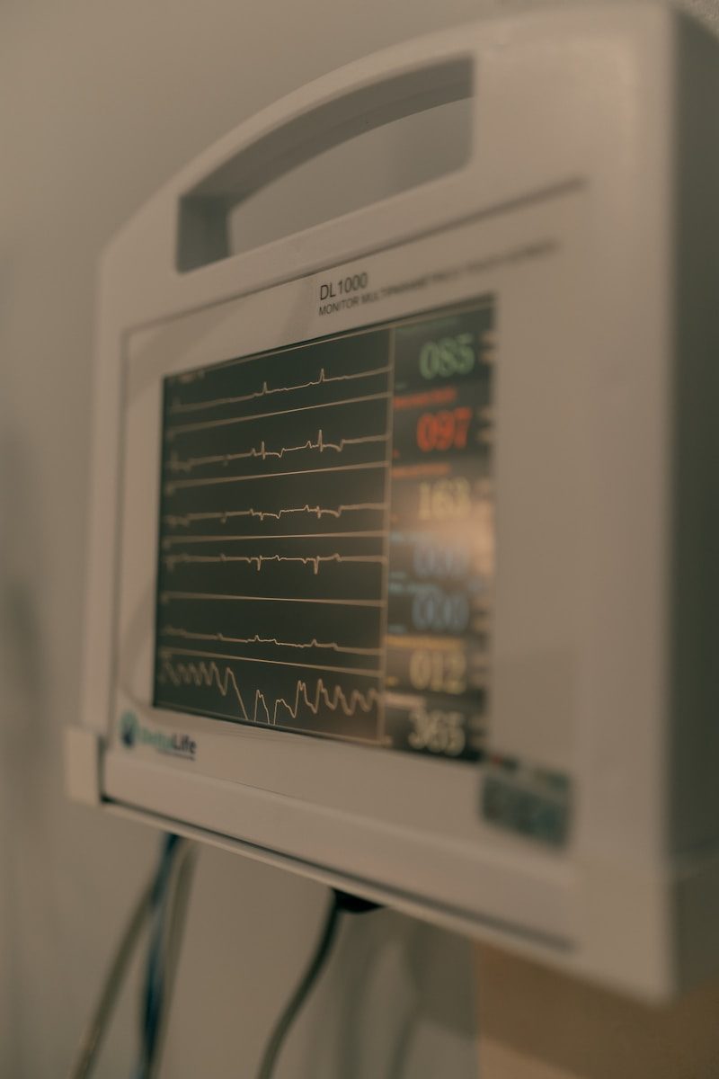 Close-up of a medical monitor displaying vital signs.